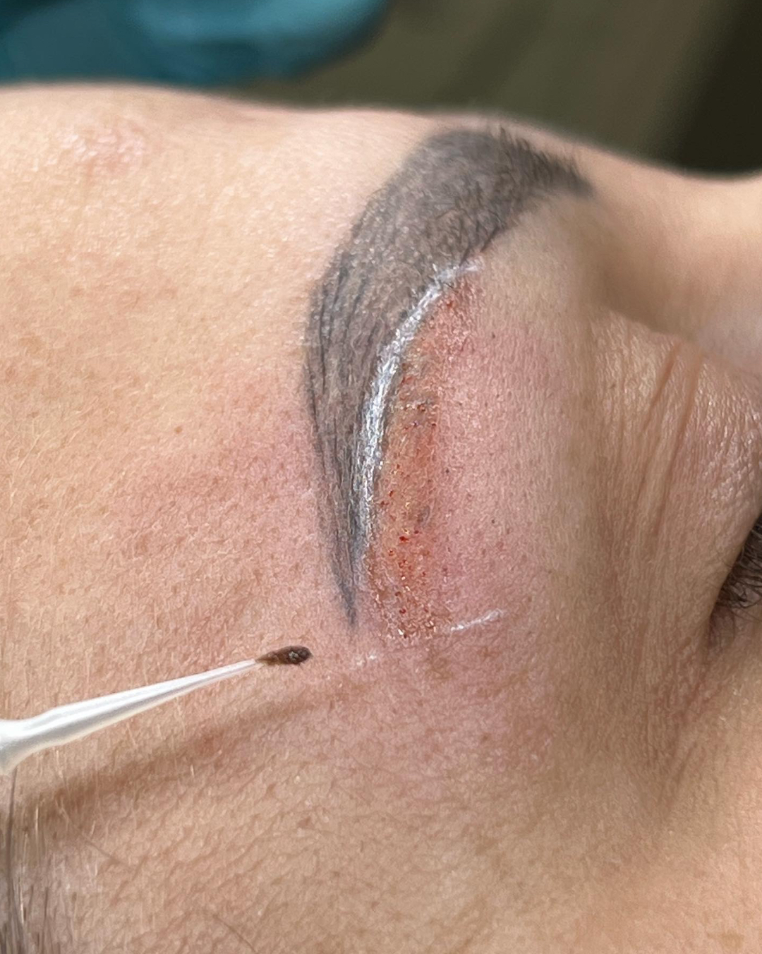 Permanent Make-up Entfernung bei Rosamina Beauty nahe Heilbronn